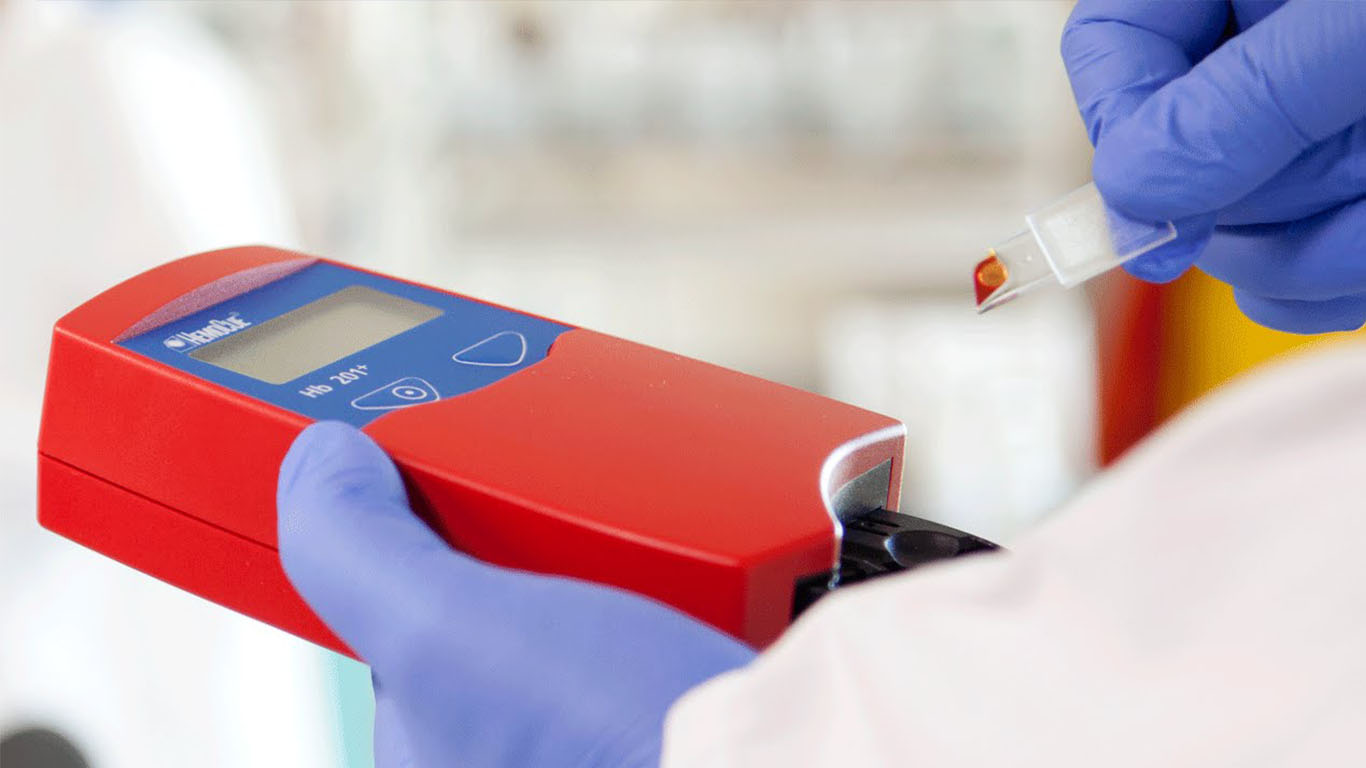 Ilustrasi pemeriksaan hemoglobin (hb)