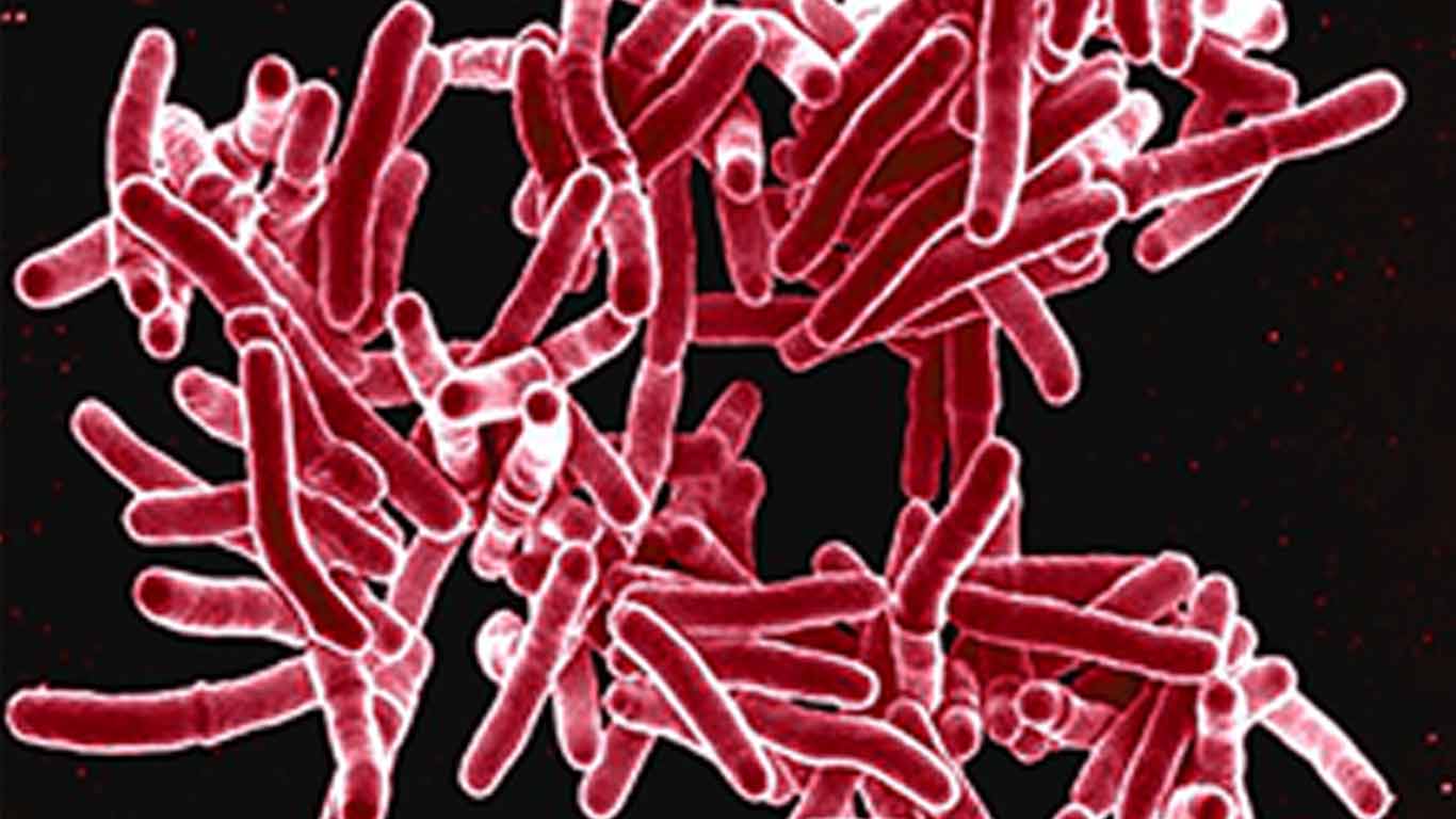 Penampakan mikroskopis M. Tuberculosis