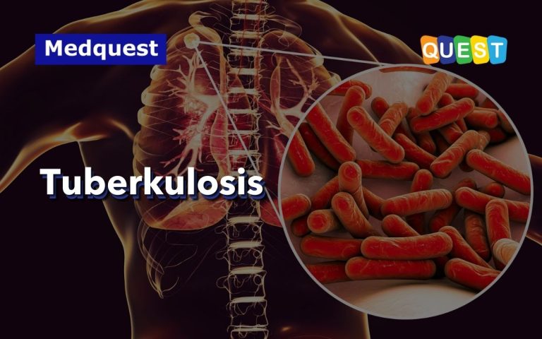 Tuberkulosis: Penyebab, Gejala dan Cara Penyembuhan