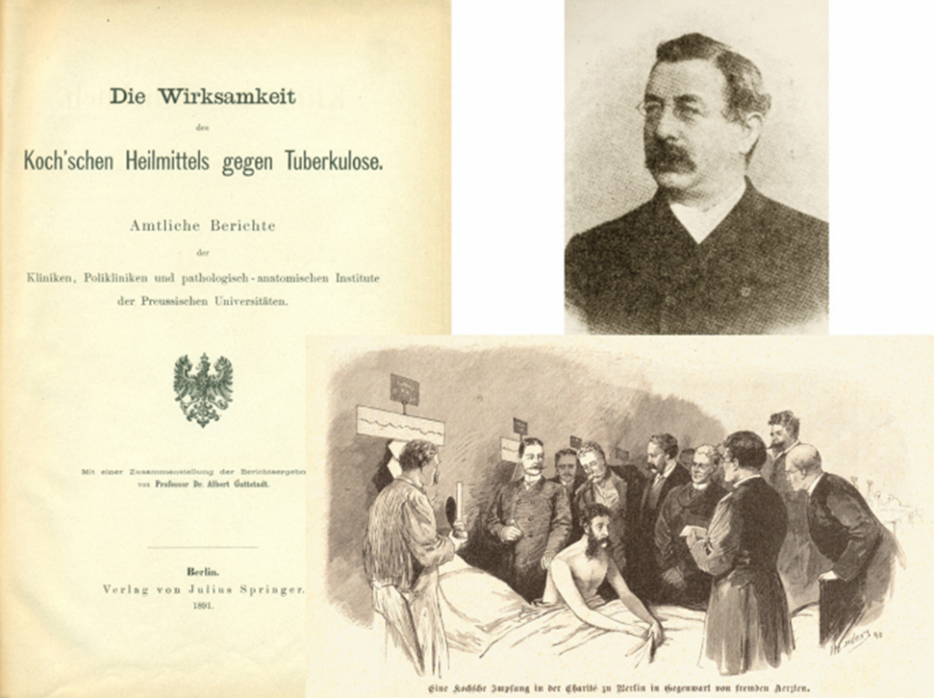 Laporan uji Klinis Koch dalam pengobatan TB beserta potret kepala peneliti dan ilustrasi vaksinasi pasien TB