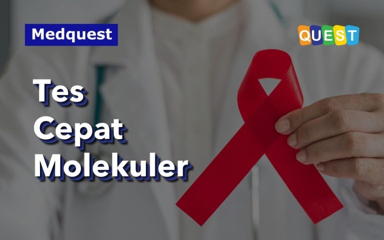 Mengenal dan Memahami Tes Cepat Molekuler (TCM) Deteksi HIV