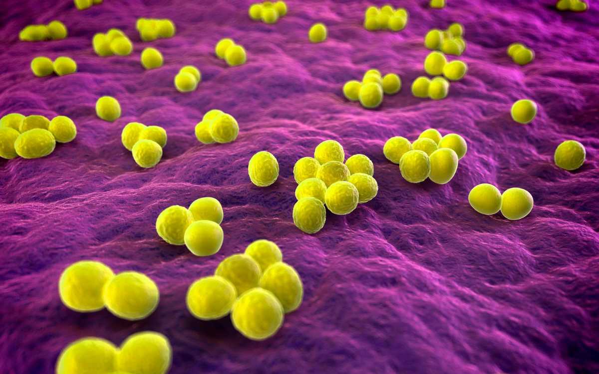 Ilustrasi komputasi Methicillin-resistant Staphylococcus aureus (MRSA)