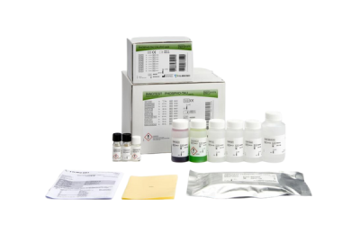 INNOTEST PHOSPHO-TAU(181P)