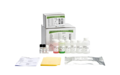 INNOTEST β-AMYLOID(1-40)