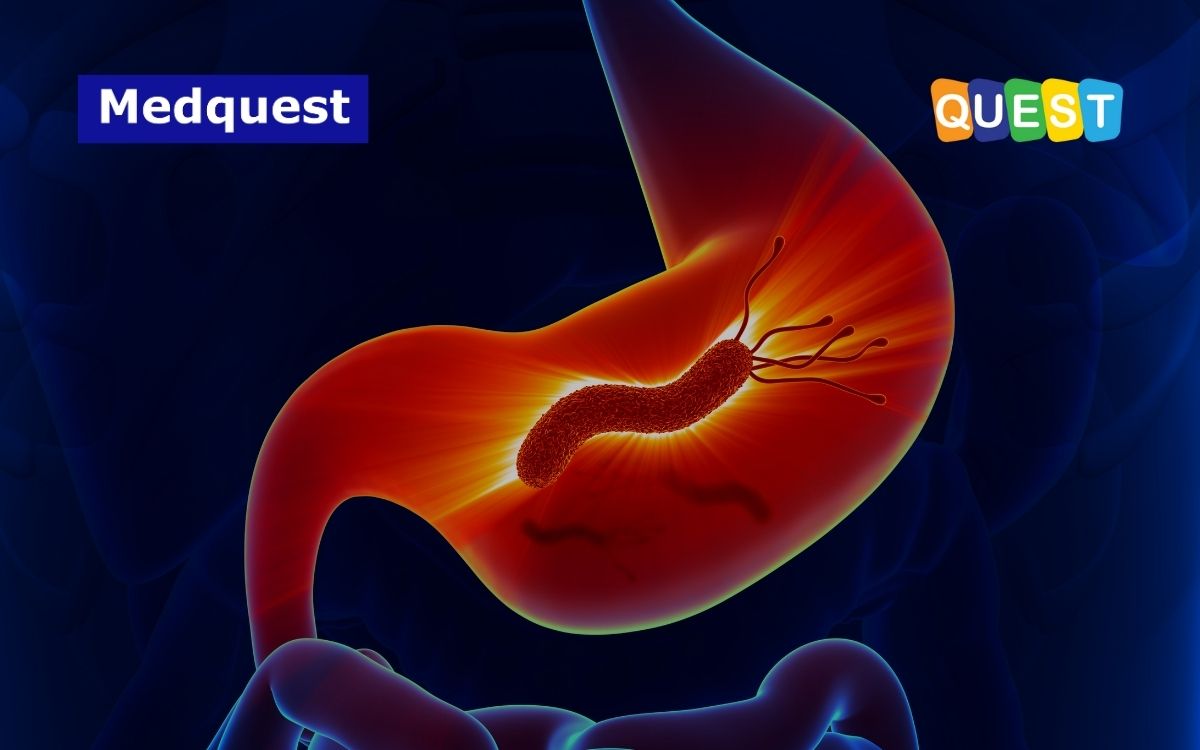 Waspadai Infeksi H. Pylori Pada Lambung: Membahayakan Nyawa!