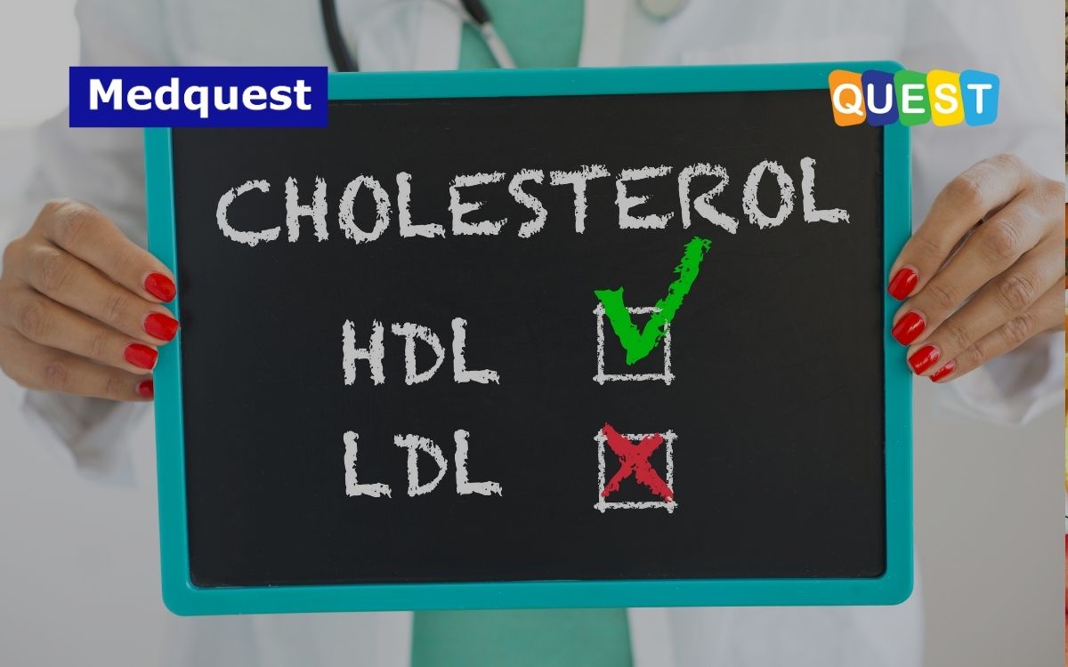Perbedaan Kolesterol Baik dan Kolesterol Jahat