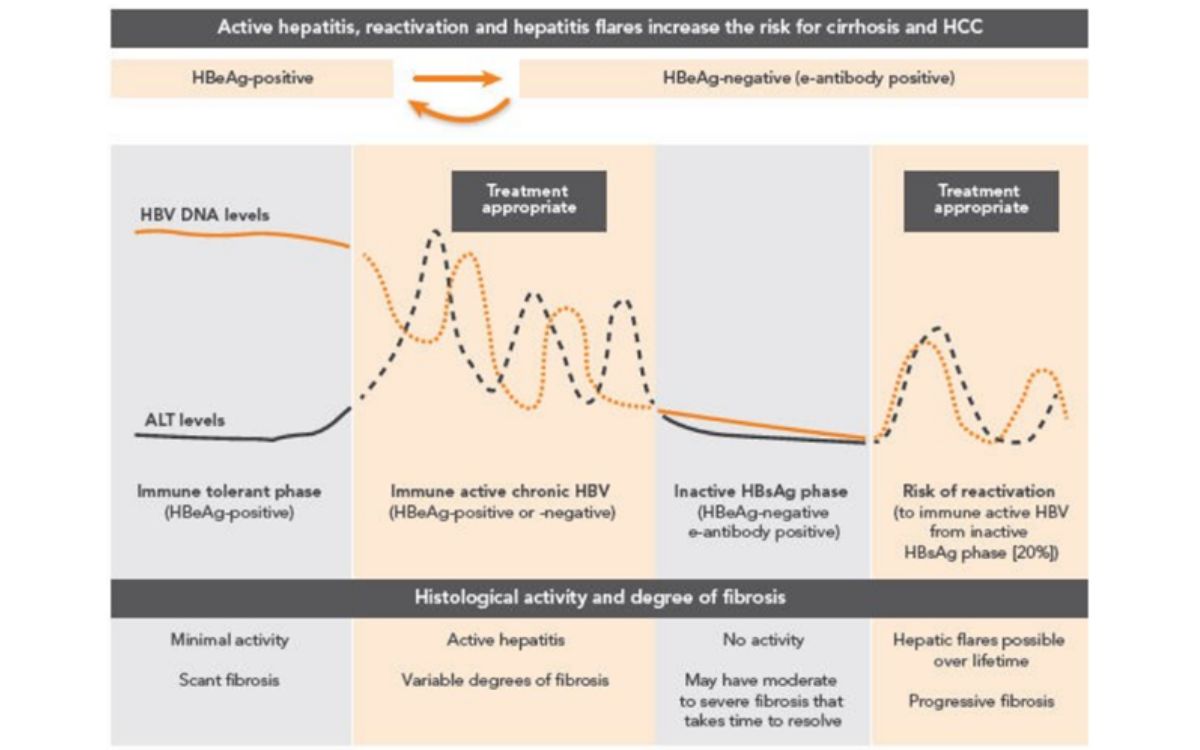 Empat fase infeksi virus Hepatitis B