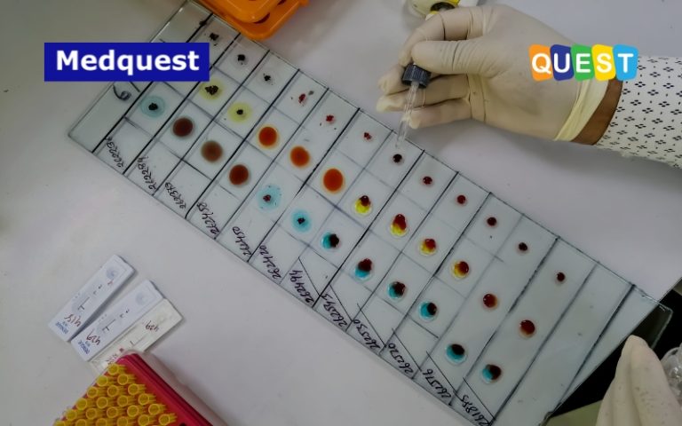 Pentingnya Ketahui Golongan Darah Agar Terhindar Komplikasi