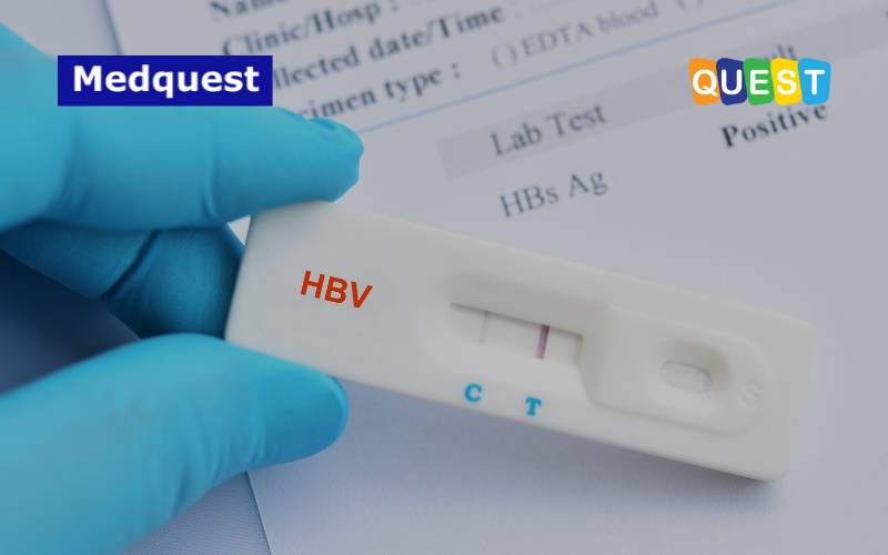 Hepatitis B: Pentingnya Pemantauan DNA HBV & Studi Kasusnya