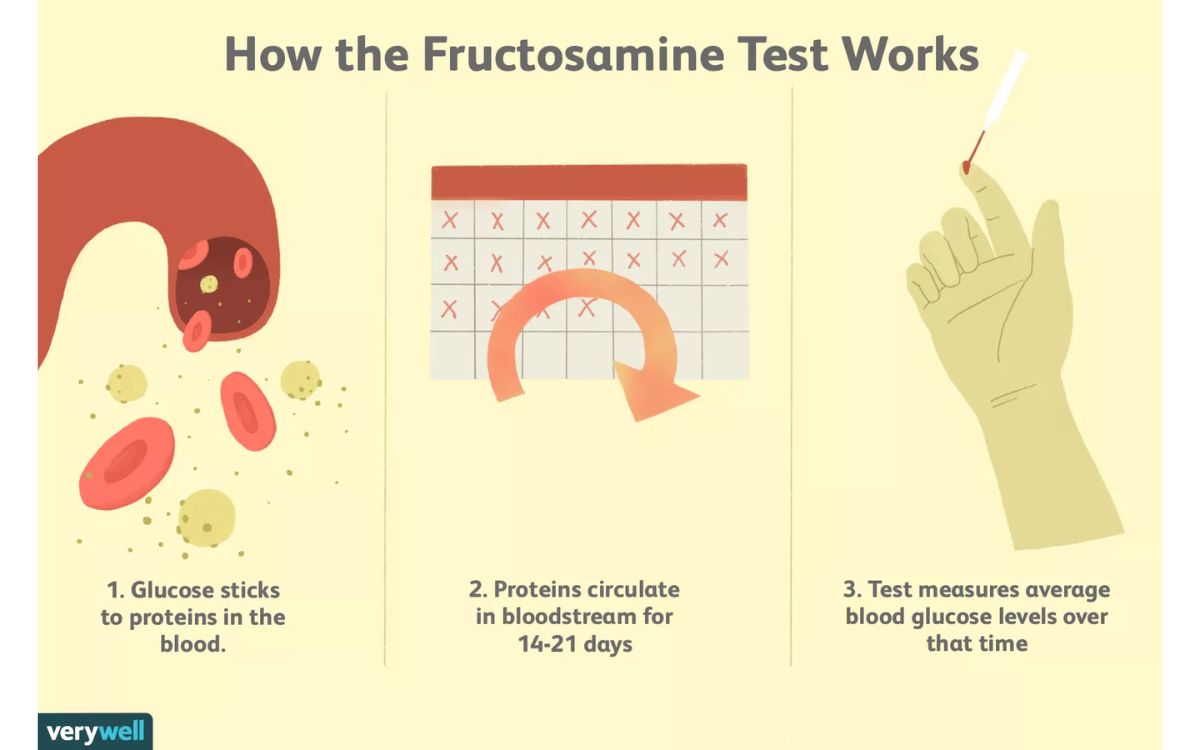 Ilustrasi cara uji GSP (fruktosamin) dilakukan. Sumber: verywell.