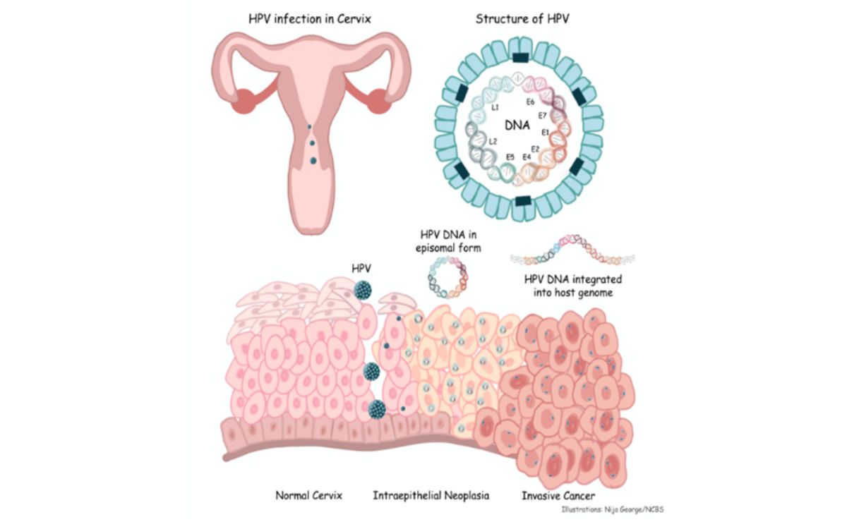 Ilustrasi mengenai Human papillomavirus (HPV).