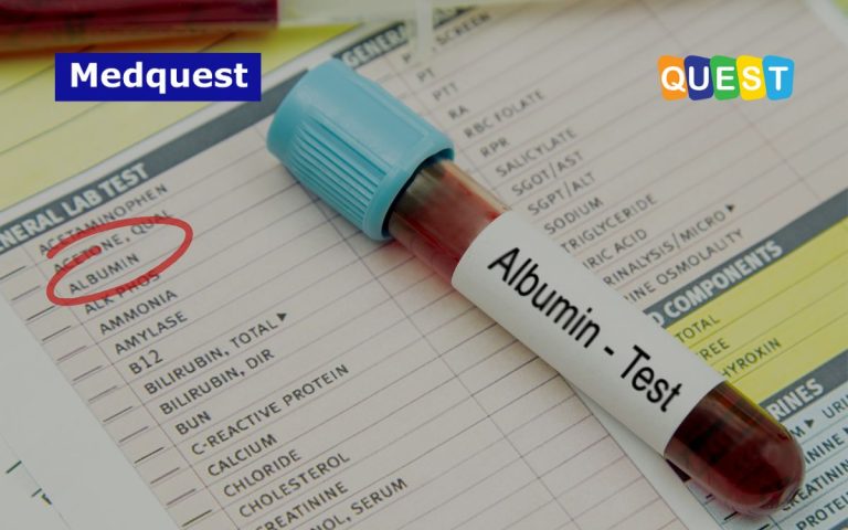 thumbnail Solusi Deteksi Microalbuminuria: Abbott Afinion 2 Analyzer