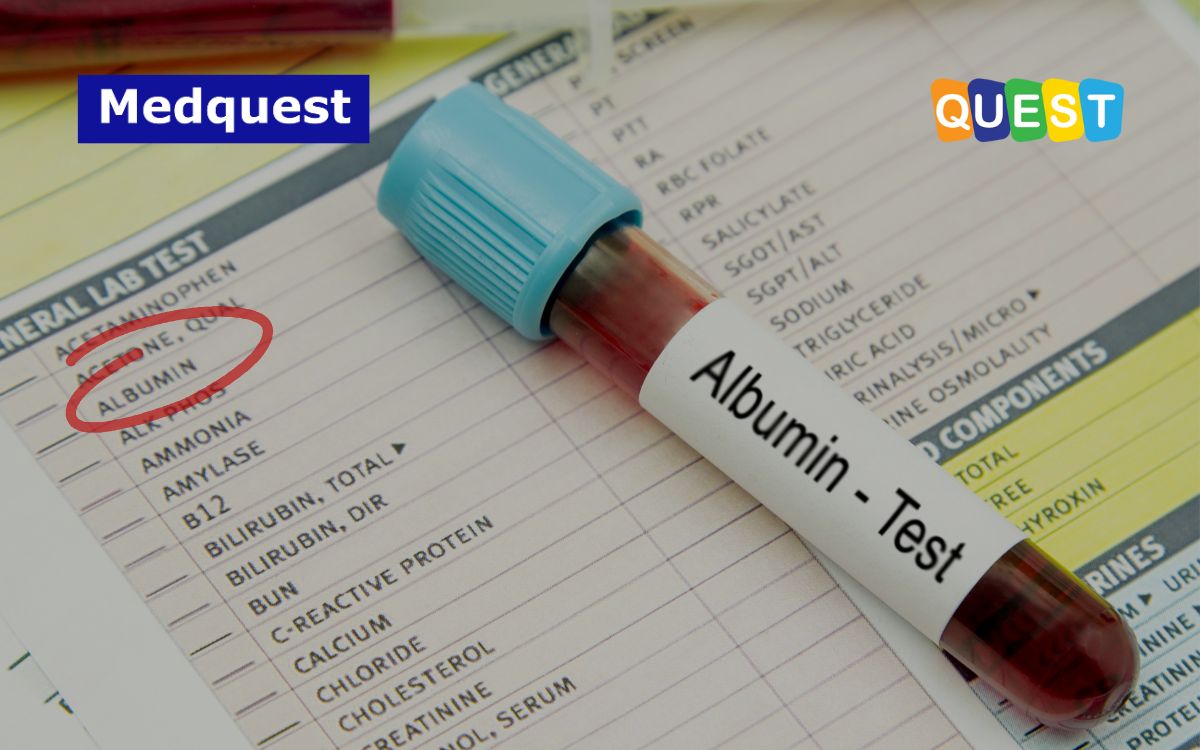 thumbnail Solusi Deteksi Microalbuminuria: Abbott Afinion 2 Analyzer