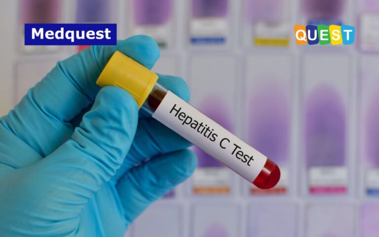 Thumbnail Eradikasi Hepatitis C Pentingnya Peran Pemantauan RNA HCV