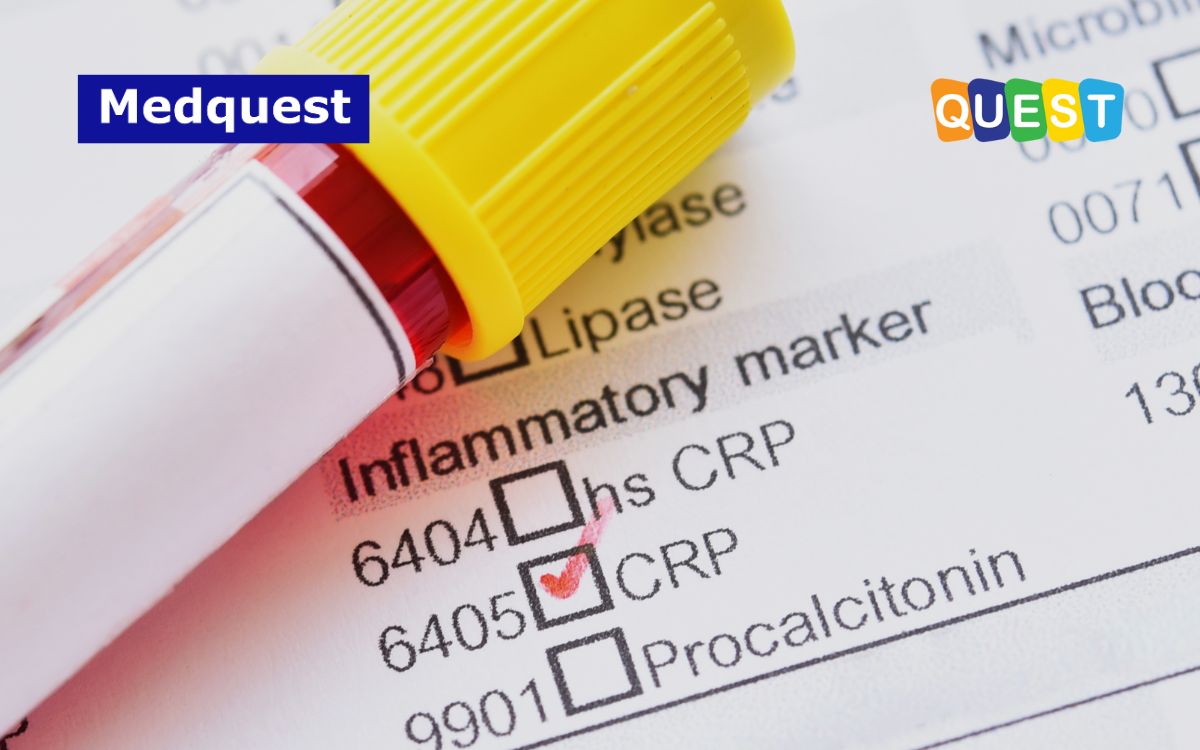 thumbnail C-Reactive Protein (CRP): Salah Satu Biomarker Inflamasi