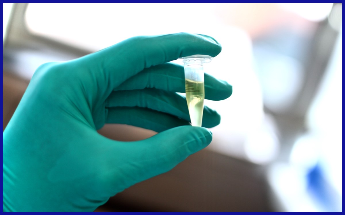 Ilustrasi Pemeriksaan Biomarker Cairan Serebrospinal