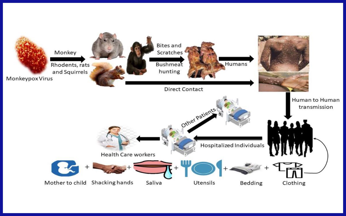 Alur penularan utama virus cacar monyet dari hewan ke manusia