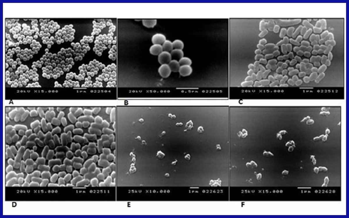 Gambar tampak MRSA. Sumber: ResearchGate.