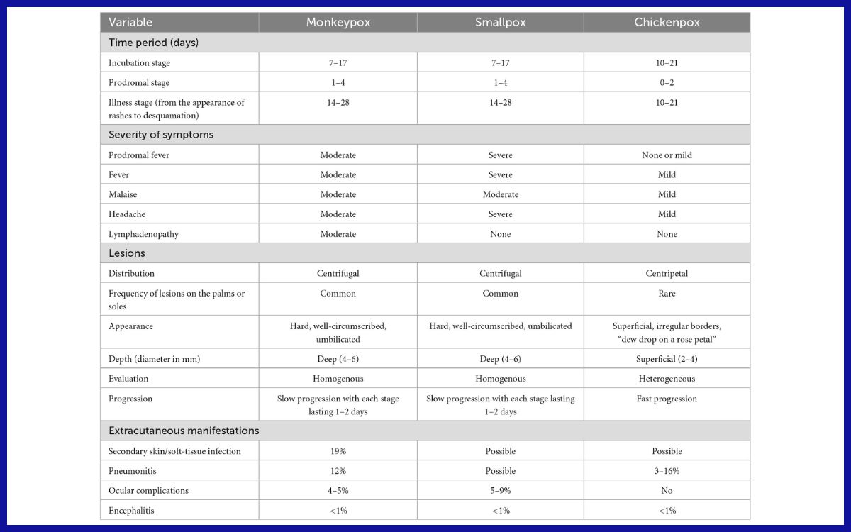 Perbandingan Fitur Klinis Cacar Monyet, Cacar, dan Cacar Air